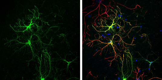 Glutamine Synthetase Antibody in Immunocytochemistry (ICC/IF)