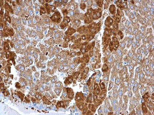 Glutamine Synthetase Antibody in Immunohistochemistry (Paraffin) (IHC (P))