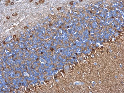 Glutamine Synthetase Antibody in Immunohistochemistry (Paraffin) (IHC (P))