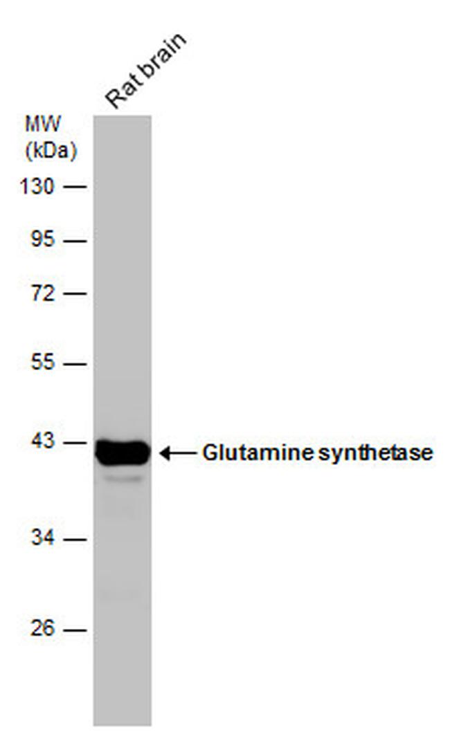 Glutamine Synthetase Antibody in Western Blot (WB)