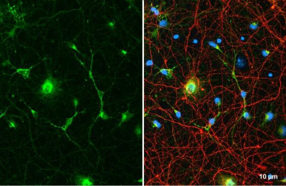 Glutamine Synthetase Antibody in Immunocytochemistry (ICC/IF)