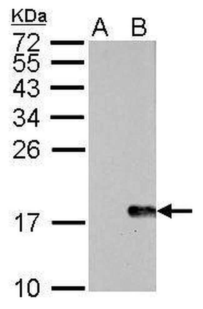 Phospho-Histone H2A.X (Ser139) Antibody in Western Blot (WB)