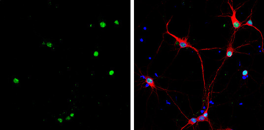 HMGB1 Antibody in Immunocytochemistry (ICC/IF)