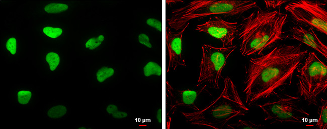 HMGB1 Antibody in Immunocytochemistry (ICC/IF)