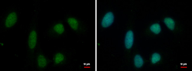 PRMT1 Antibody in Immunocytochemistry (ICC/IF)