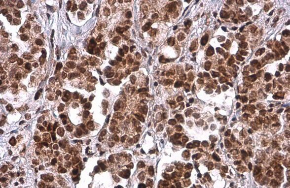 PRMT1 Antibody in Immunohistochemistry (Paraffin) (IHC (P))