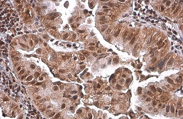 PRMT1 Antibody in Immunohistochemistry (Paraffin) (IHC (P))