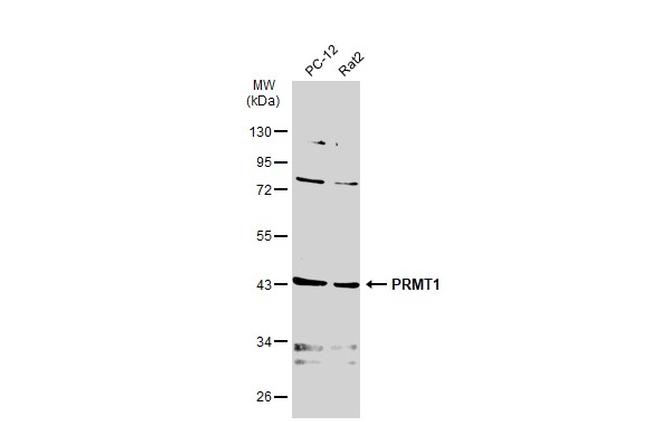 PRMT1 Antibody in Western Blot (WB)