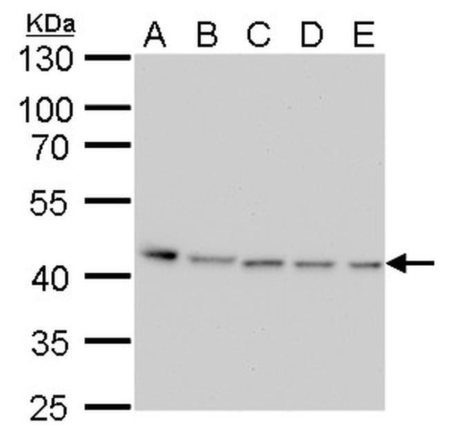 PRMT1 Antibody in Western Blot (WB)