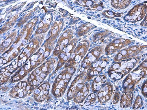 IDE Antibody in Immunohistochemistry (Paraffin) (IHC (P))