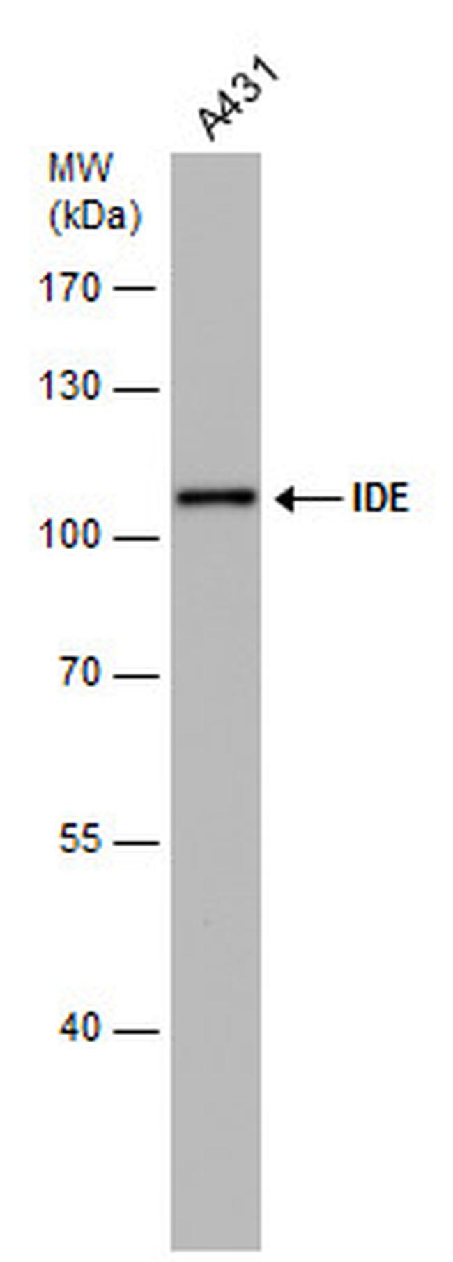 IDE Antibody in Western Blot (WB)