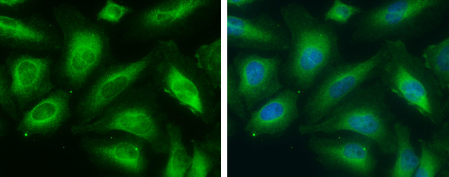 ME1 Antibody in Immunocytochemistry (ICC/IF)