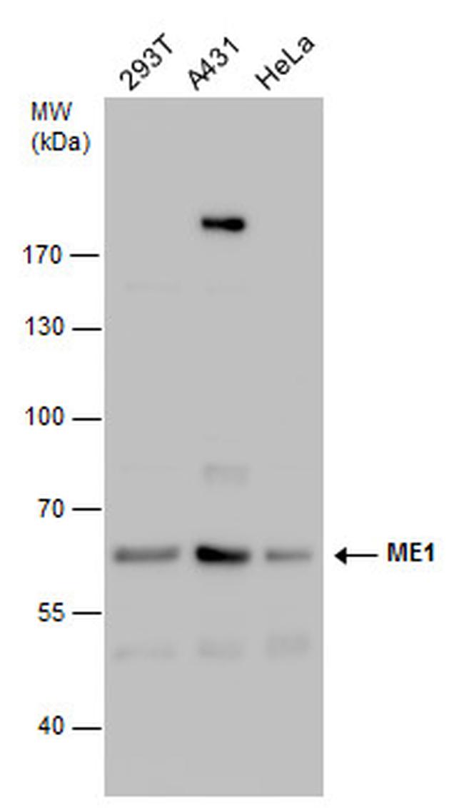 ME1 Antibody in Western Blot (WB)