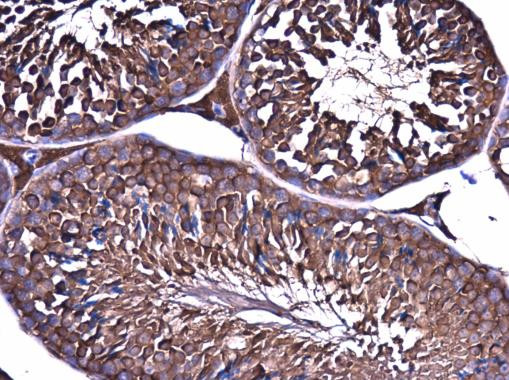 ME1 Antibody in Immunohistochemistry (Paraffin) (IHC (P))