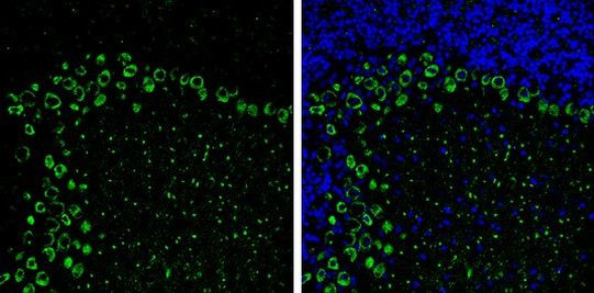 MYH10 Antibody in Immunohistochemistry (Frozen) (IHC (F))