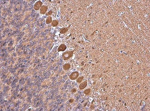 MYH10 Antibody in Immunohistochemistry (Paraffin) (IHC (P))