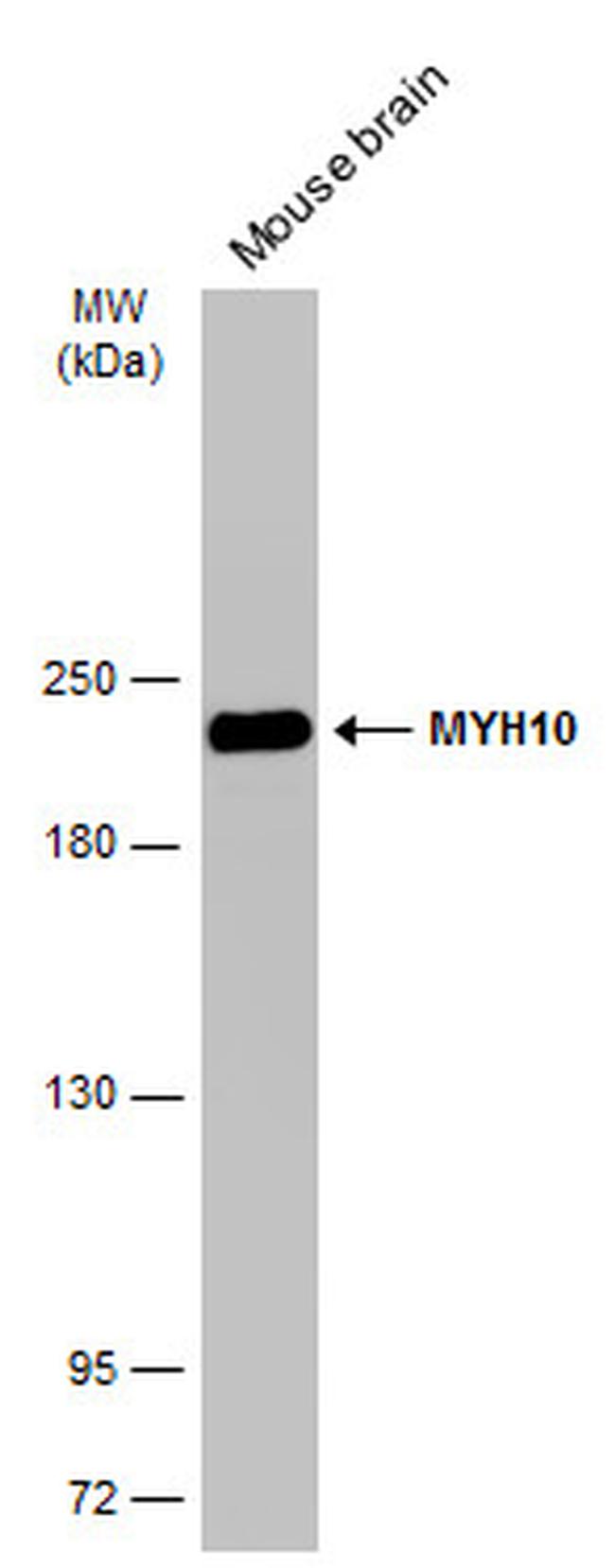 MYH10 Antibody in Western Blot (WB)