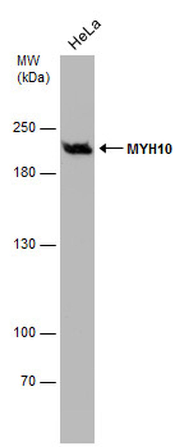 MYH10 Antibody in Western Blot (WB)