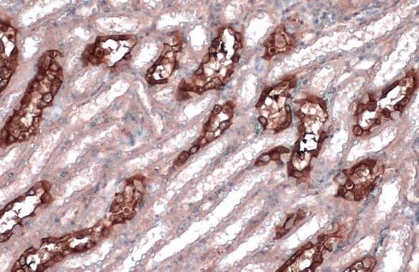 MYH10 Antibody in Immunohistochemistry (Paraffin) (IHC (P))