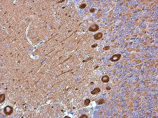 MYH10 Antibody in Immunohistochemistry (Paraffin) (IHC (P))