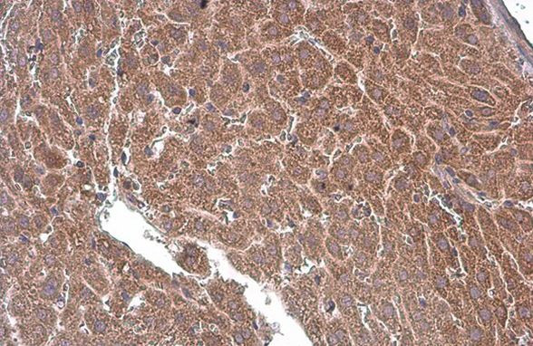 PLS3 Antibody in Immunohistochemistry (Paraffin) (IHC (P))