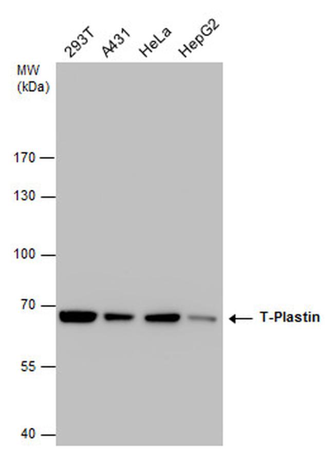 PLS3 Antibody in Western Blot (WB)