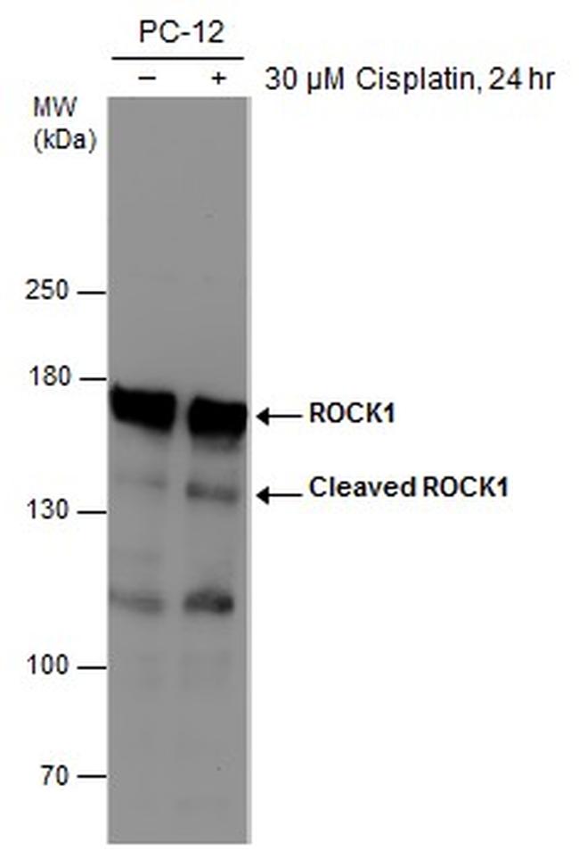 ROCK1 Antibody in Western Blot (WB)