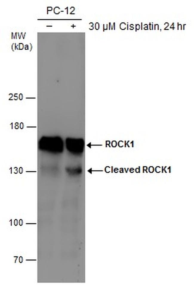 ROCK1 Antibody in Western Blot (WB)