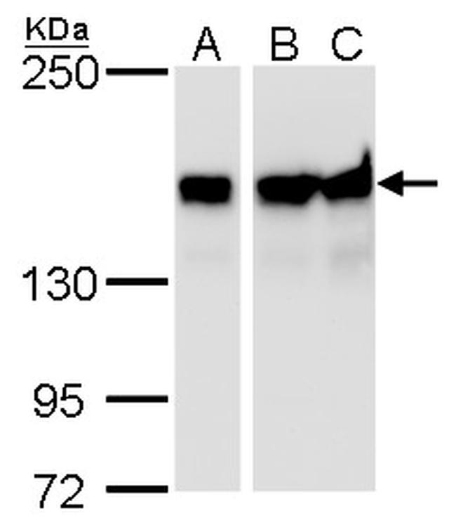 ROCK1 Antibody in Western Blot (WB)