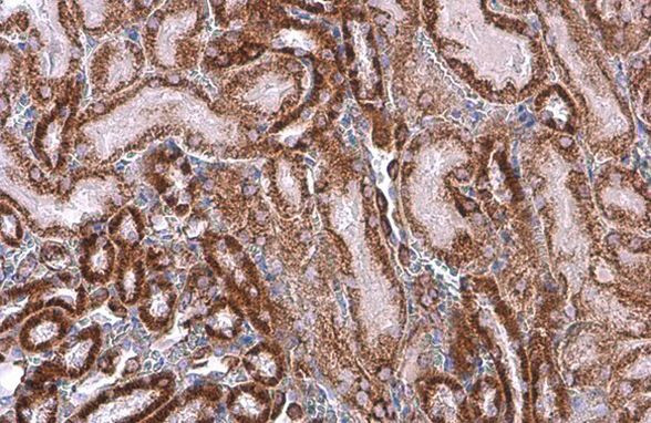 SDHA Antibody in Immunohistochemistry (Paraffin) (IHC (P))