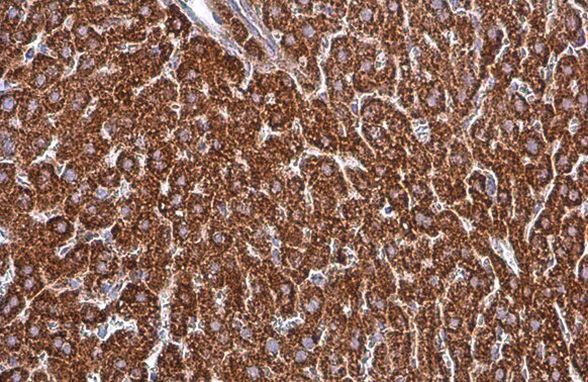 SDHA Antibody in Immunohistochemistry (Paraffin) (IHC (P))