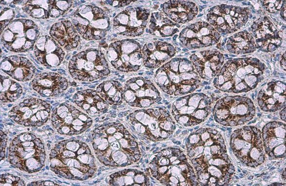 SDHA Antibody in Immunohistochemistry (Paraffin) (IHC (P))