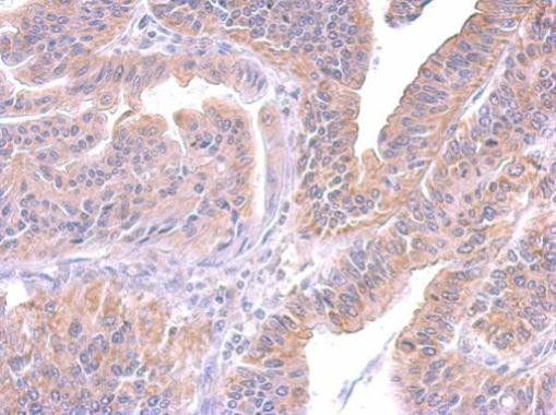 SUPV3L1 Antibody in Immunohistochemistry (Paraffin) (IHC (P))