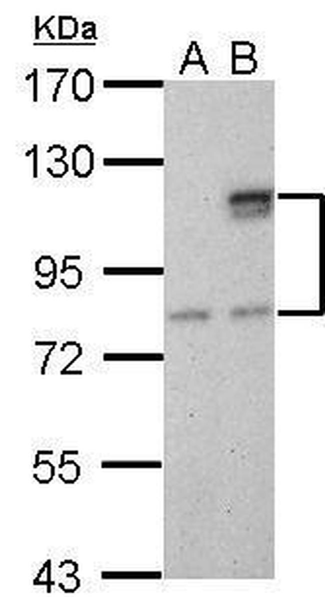 SUPV3L1 Antibody in Western Blot (WB)