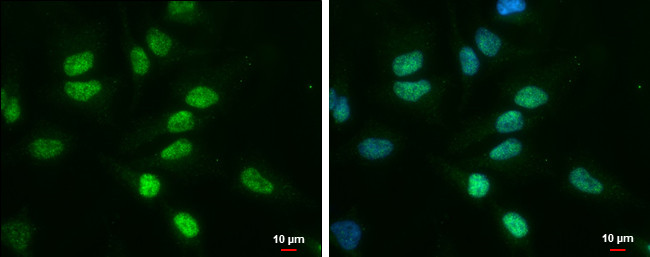 TDG Antibody in Immunocytochemistry (ICC/IF)