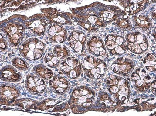 Talin 1 Antibody in Immunohistochemistry (Paraffin) (IHC (P))