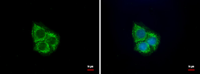 UQCRC1 Antibody in Immunocytochemistry (ICC/IF)