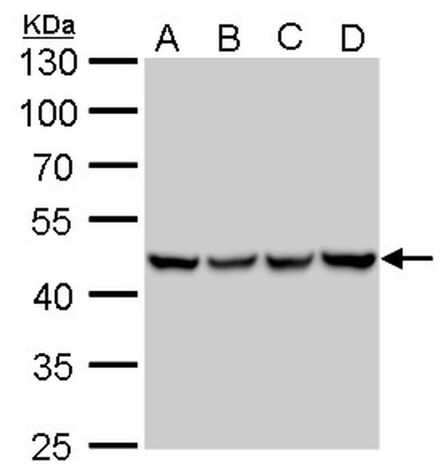 UQCRC1 Antibody in Western Blot (WB)