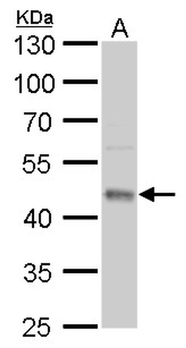 UQCRC1 Antibody in Western Blot (WB)