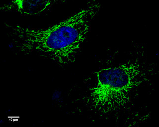 UQCRC1 Antibody in Immunocytochemistry (ICC/IF)