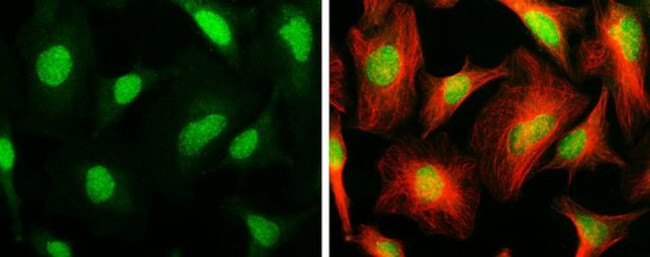 ARID1A Antibody in Immunocytochemistry (ICC/IF)