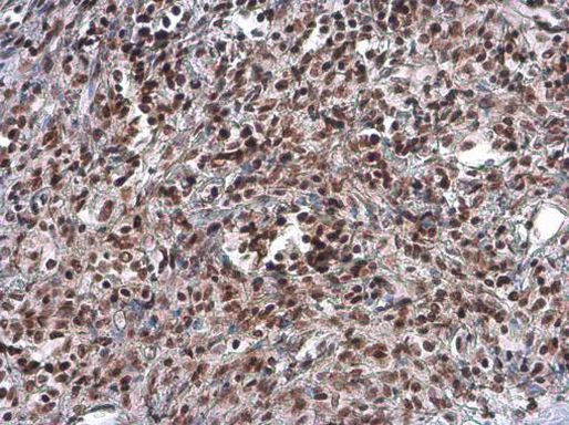 ARID1A Antibody in Immunohistochemistry (Paraffin) (IHC (P))