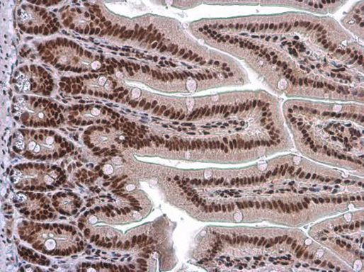 ARID1A Antibody in Immunohistochemistry (Paraffin) (IHC (P))