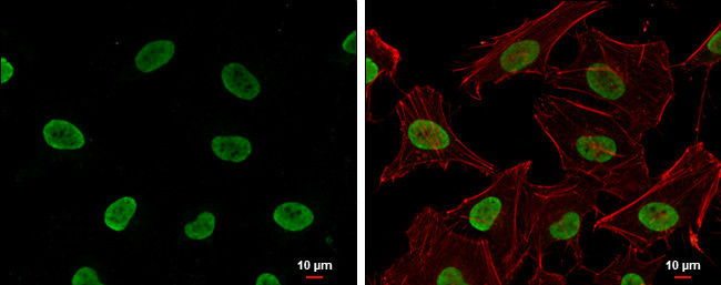 H4K16ac Antibody in Immunocytochemistry (ICC/IF)