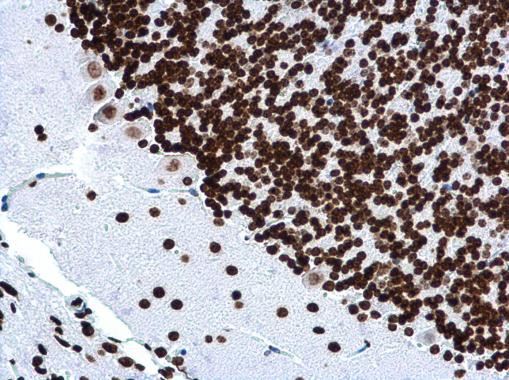 H4K16ac Antibody in Immunohistochemistry (Paraffin) (IHC (P))