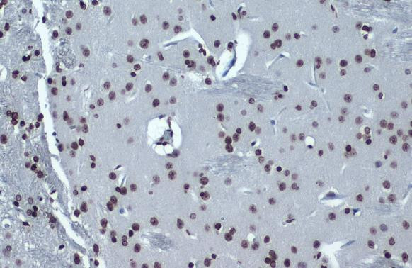 H4K16ac Antibody in Immunohistochemistry (Paraffin) (IHC (P))