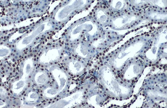 H4K16ac Antibody in Immunohistochemistry (Paraffin) (IHC (P))