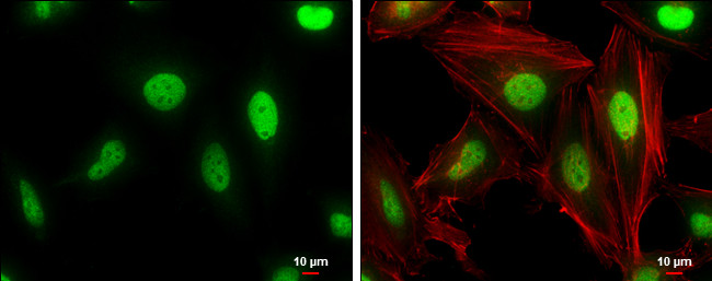 Cullin 4A Antibody in Immunocytochemistry (ICC/IF)