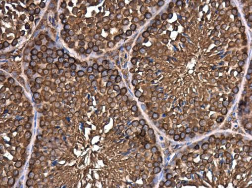 eIF3h Antibody in Immunohistochemistry (Paraffin) (IHC (P))