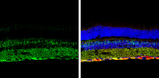 SQSTM1 Antibody in Immunohistochemistry (Frozen) (IHC (F))